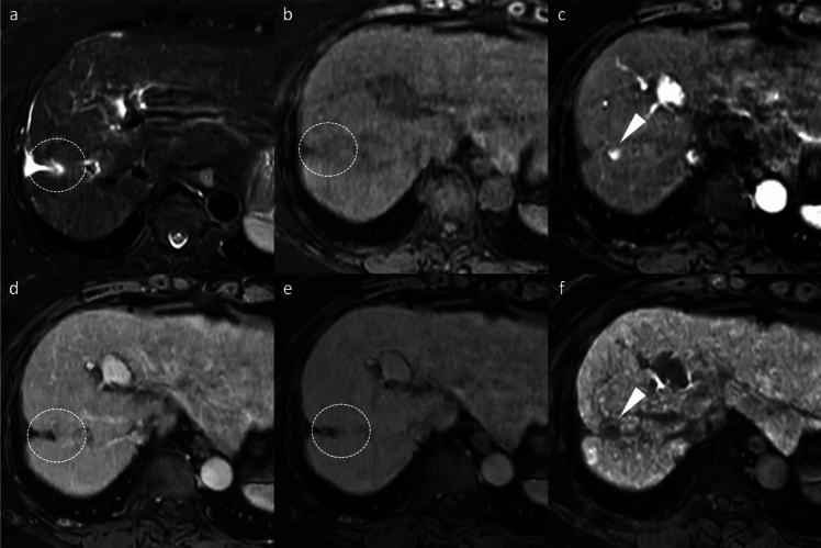 Figure 17