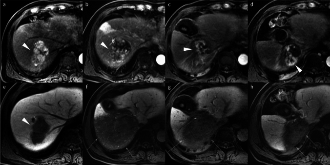 Figure 18