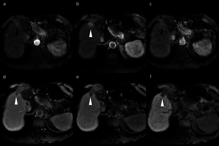 Figure 19