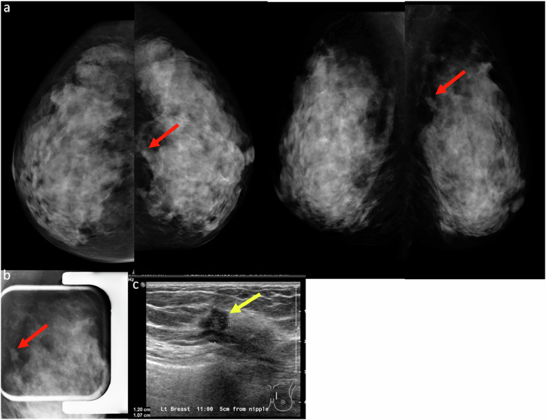 Figure 10