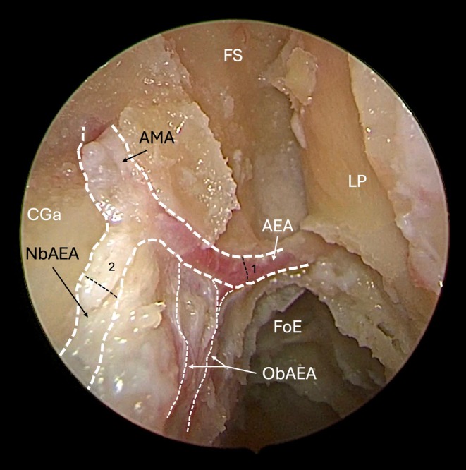 FIGURE 2