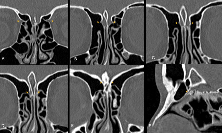 FIGURE 1