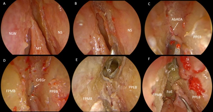 FIGURE 3