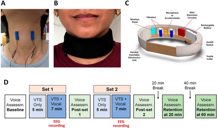 FIGURE 1