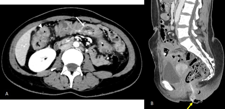 Figure 5