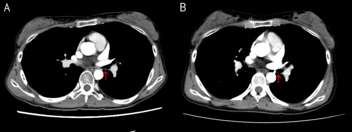 FIGURE 2