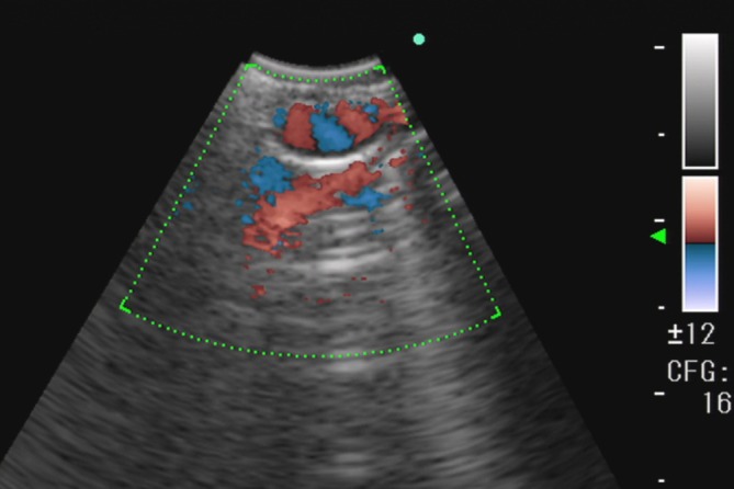 FIGURE 3