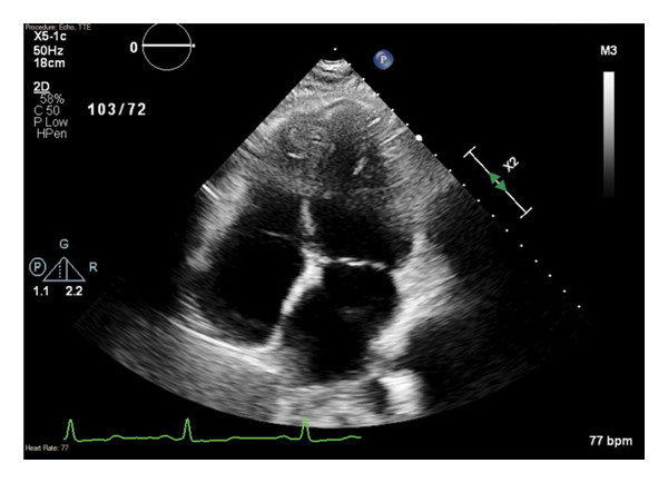 Figure 4