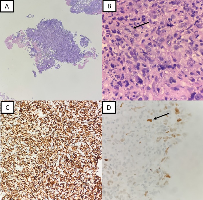FIGURE 2