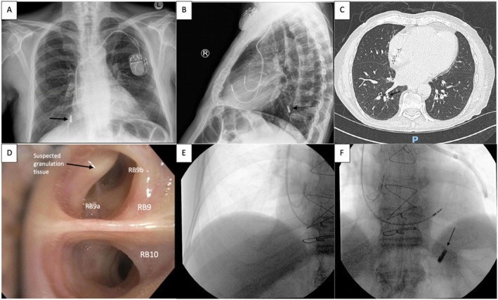 FIGURE 1