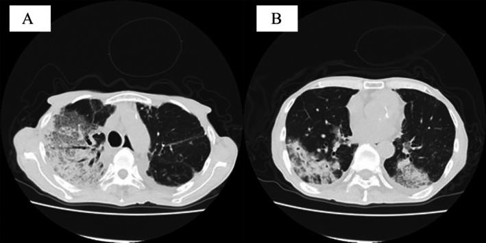 FIGURE 2