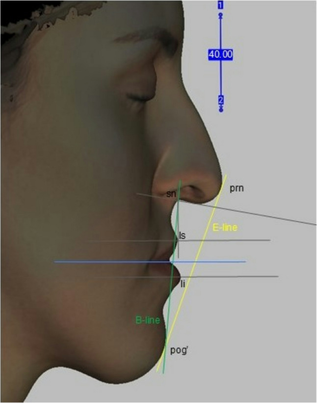 Figure 8