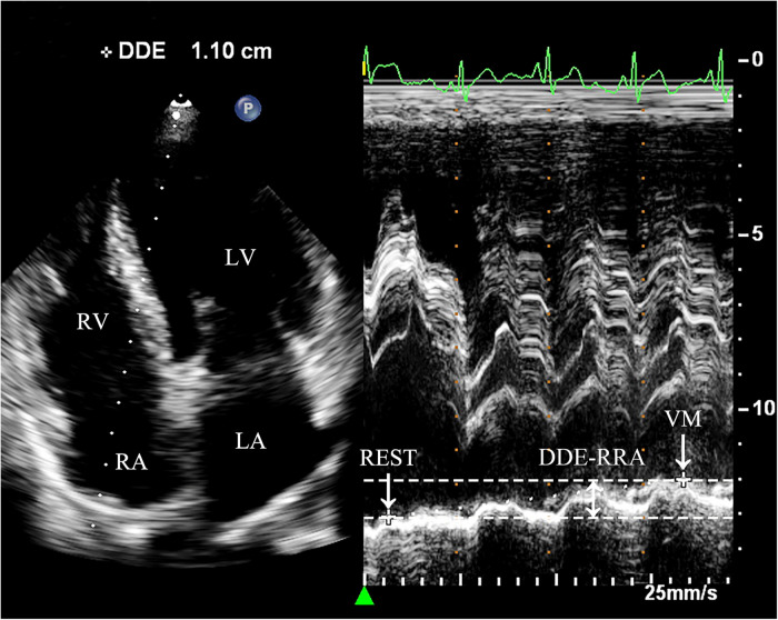 Figure 2