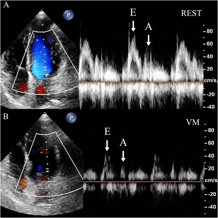 Figure 3
