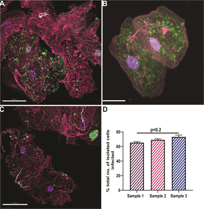 Fig 2
