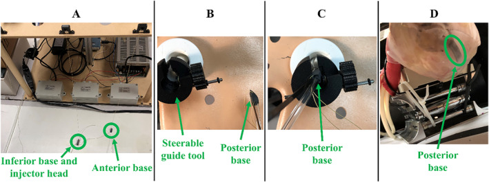 FIGURE 14