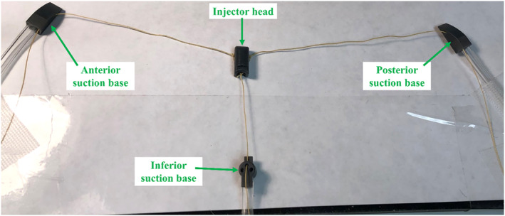 FIGURE 4
