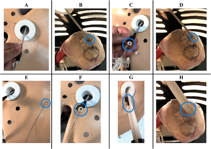 FIGURE 13