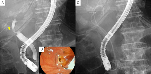 FIGURE 2