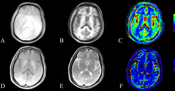 Fig 2