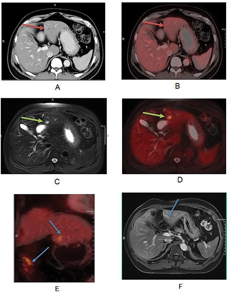 Fig. 6