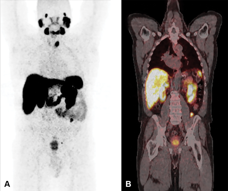 Fig. 1