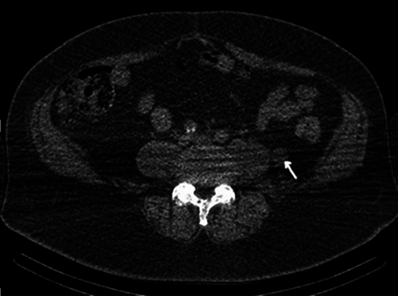 Fig. 4