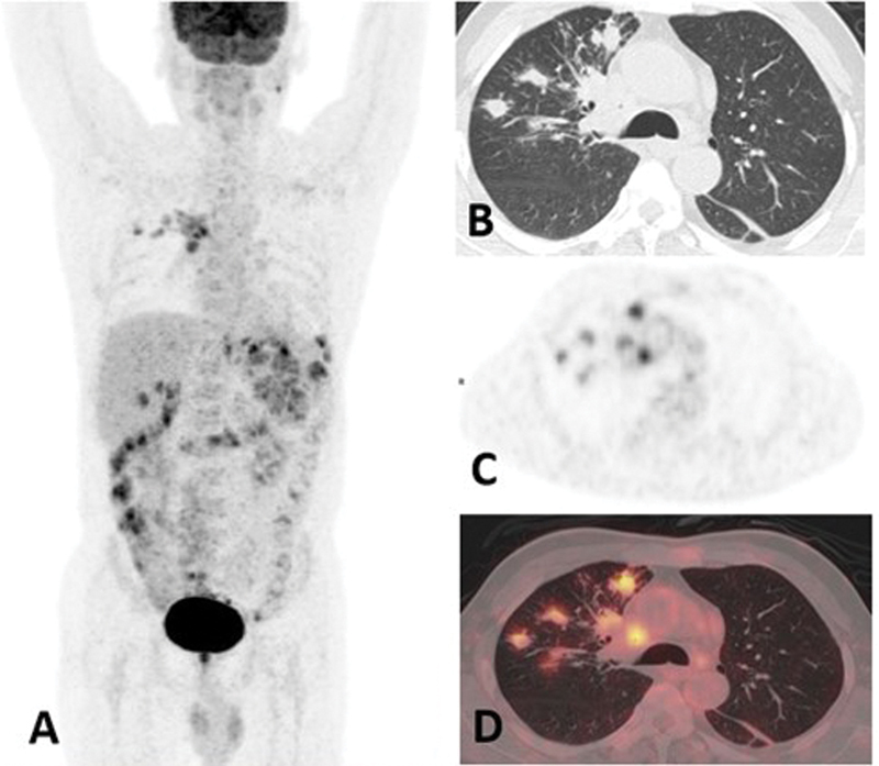 Fig. 4