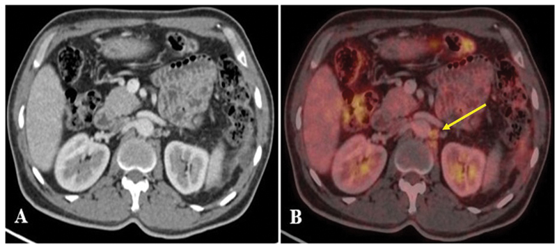 Fig. 6