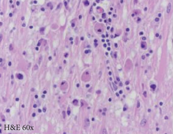 Figure 10