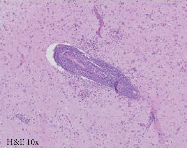Figure 12