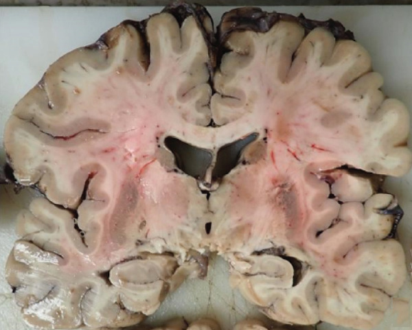 Figure 14