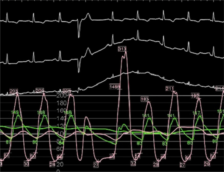 Figure 9