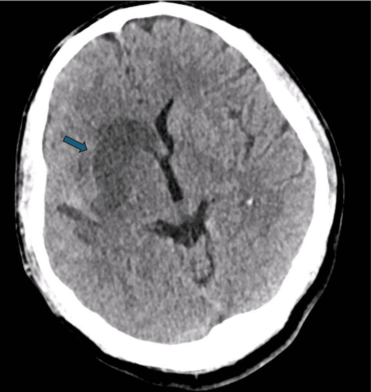 Figure 6