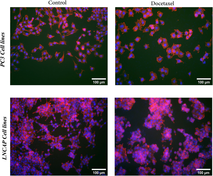 Figure 41