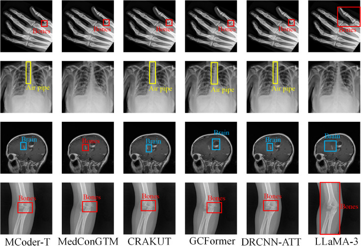 Figure 33