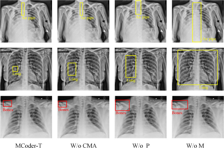 Figure 34