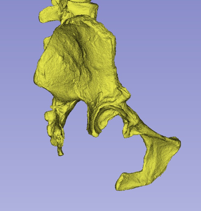 Figure 18