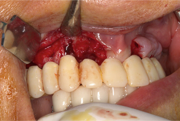 Figure 6