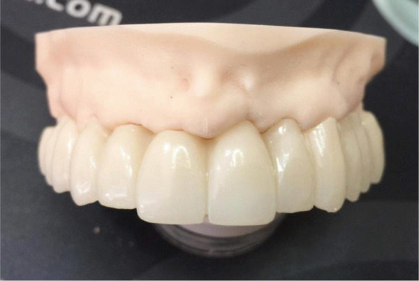 Figure 9