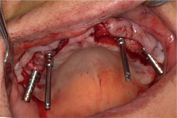 Figure 10