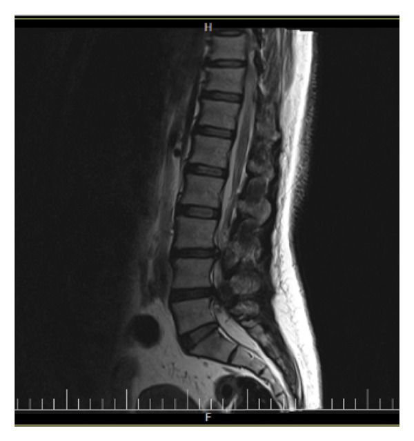 Figure 14