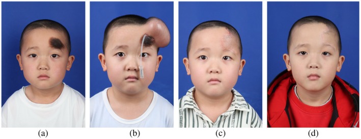 FIGURE 2