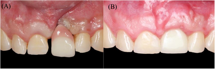 FIGURE 11