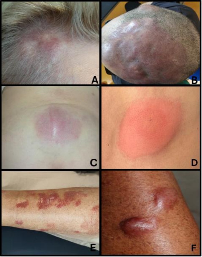 FIGURE 1