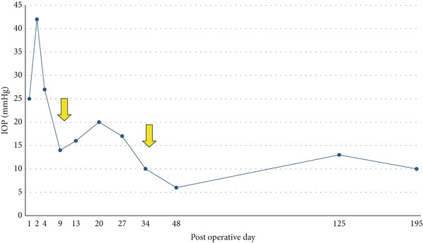 Figure 12