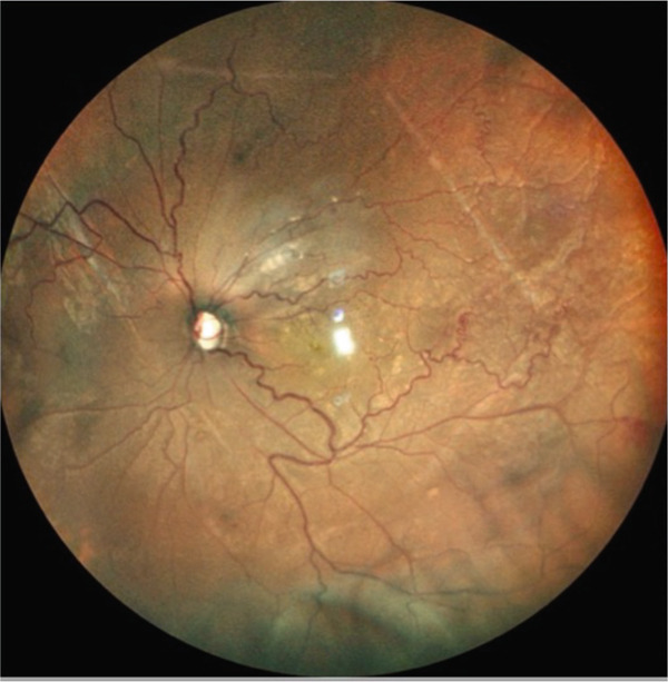 Figure 14