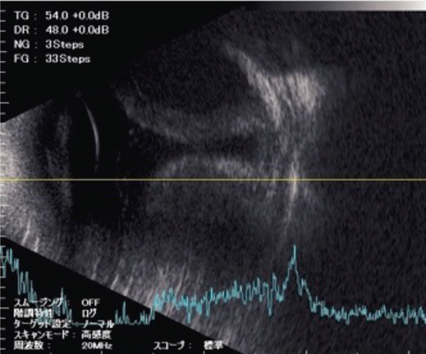 Figure 15