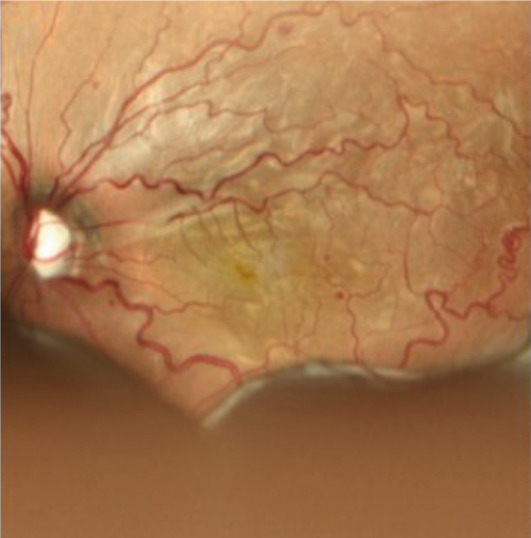 Figure 16