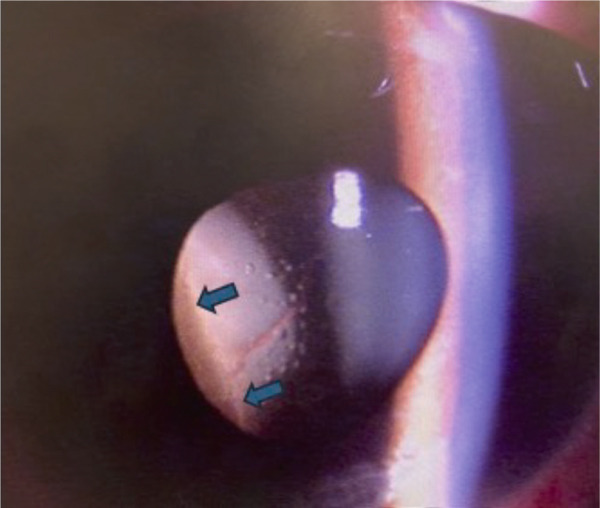 Figure 17